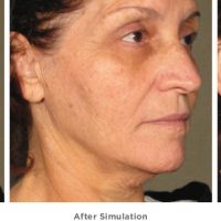 LÁP ĐẶC INOX 304 - 18 mm