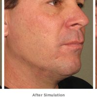 LÁP ĐẶC INOX 201 - 18mm