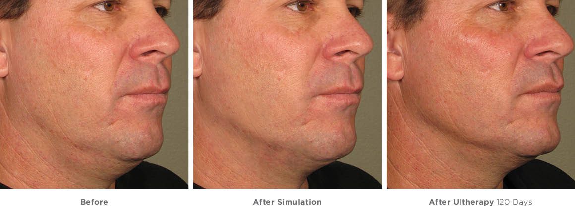 Tìm Hiều Kỹ Thuật Và Quy Trình  In Ống Đồng Chất Lượng