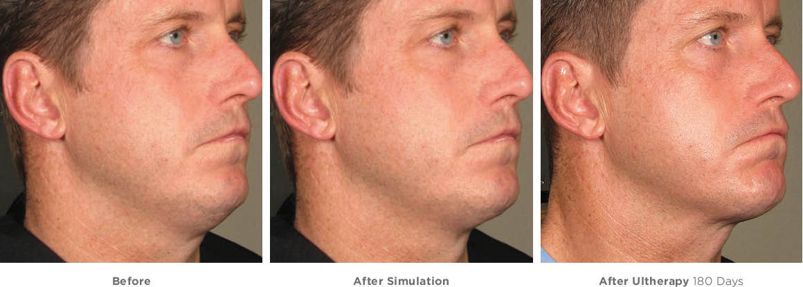 In ấn đồng phục thể thao