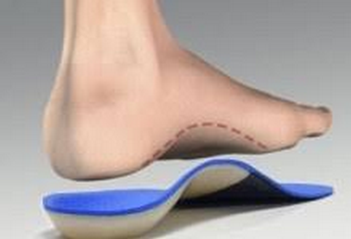 Chọn giày cho bàn chân bẹt dài tạo cho bạn cảm giác thoải mái
